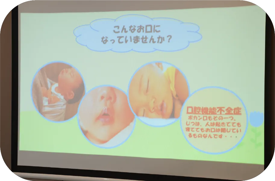 口腔機能不全症のセルフチェックを説明するスライド