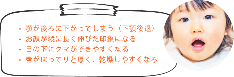 顎が後ろに下がってしまう（下顎後退）お顔が縦に長く伸びた印象になる 目の下にクマができやすくなる 唇がぽってりと厚く、乾燥しやすくなる