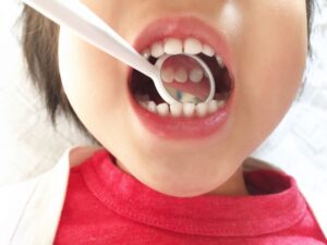 歯科で口腔内観察中の子ども